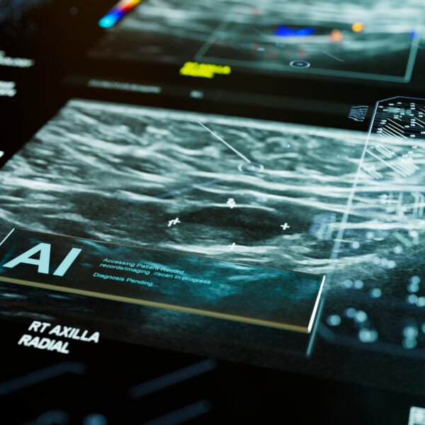 Mirai: The AI Model That Predicts Breast Cancer Risk Before Tumors Appear